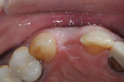 Dsc 6993 bs5sd0 - Eugenol
