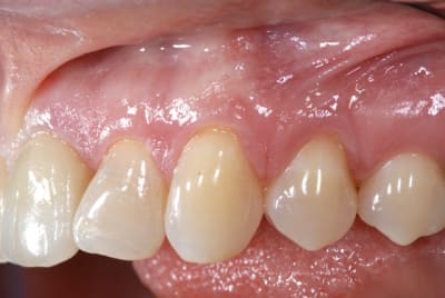 Dsc 7045 eqrtzy - Eugenol