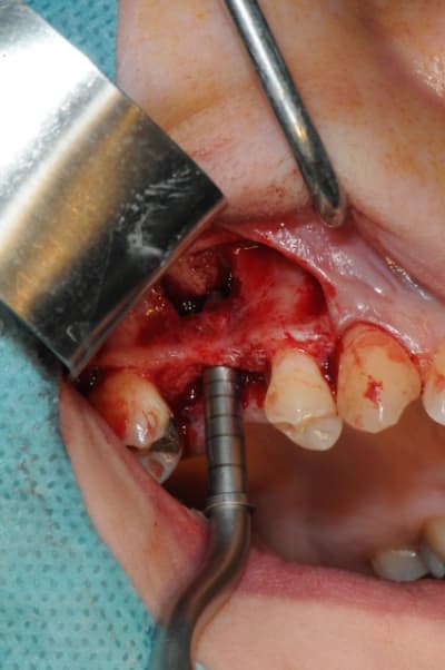 Dsc 7191 ukqizf - Eugenol