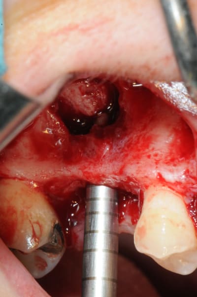 Dsc 7195 tatcs2 - Eugenol