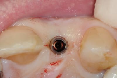 Dsc 7340 e4anwz - Eugenol