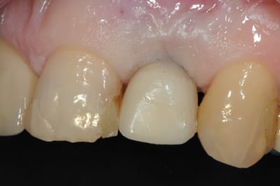 Dsc 7358 nqqbwf - Eugenol