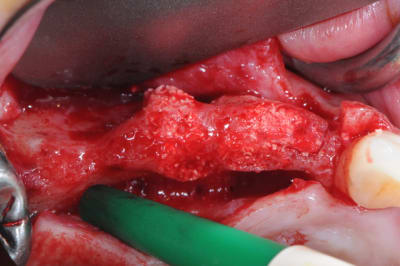 Dsc 7715 bncliv - Eugenol