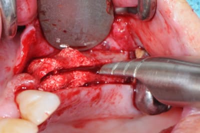 Dsc 7718 xizgc1 - Eugenol