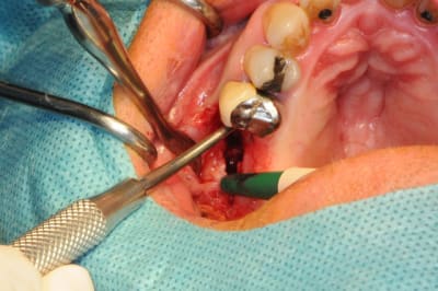 Dsc 8446 pdldd6 - Eugenol