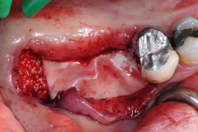 Dsc 8460 tm6e7x - Eugenol