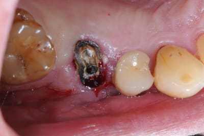 Dsc 8860 xuoabs - Eugenol