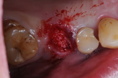 Dsc 8861 ivwiaw - Eugenol