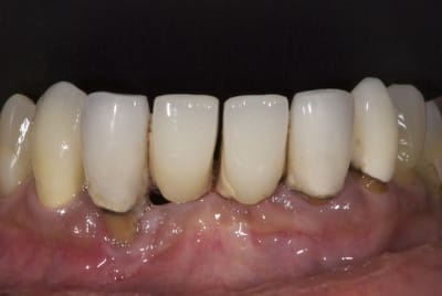 Dsc 9916 v7fjep - Eugenol