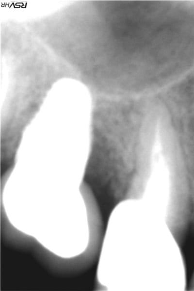 Duo5 kwpmbc - Eugenol