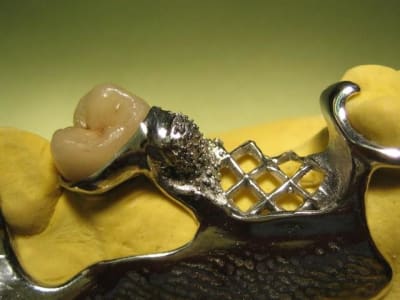 D colletage gingival lz0jwo - Eugenol