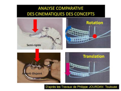 D placements comparatifs gwnhng - Eugenol
