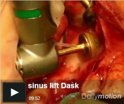 Dask hkhkka - Eugenol