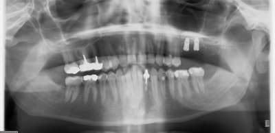 Dask u8aj8t - Eugenol