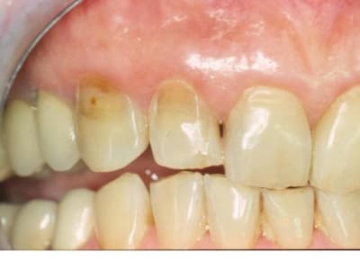 Diapositive1 k39bqq - Eugenol