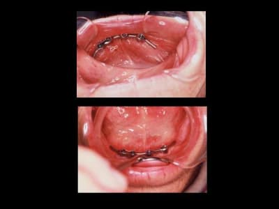 Diapositive4 wuvtvm - Eugenol
