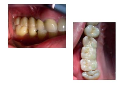 Diapositive6 zssenm - Eugenol