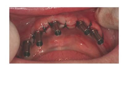 Diapositive7 ldbola - Eugenol
