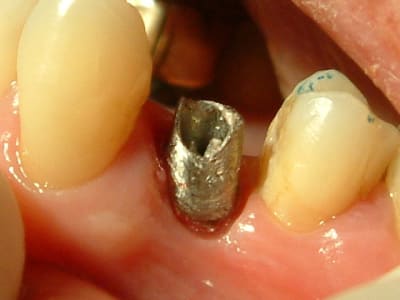 Dscf0003 qhwphj - Eugenol