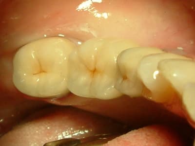 Dscf0008 efkwm2 - Eugenol