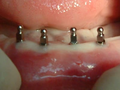 Dscf0011 ei1vh8 - Eugenol