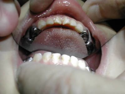 Dscn1843 nj4oly - Eugenol