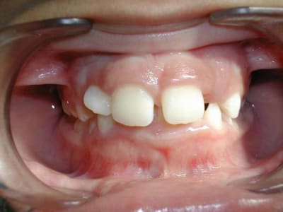 Dscn1902 edzrxq - Eugenol