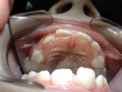 Dscn2062 syg8kc - Eugenol