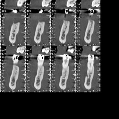 E0008 t35gpr - Eugenol