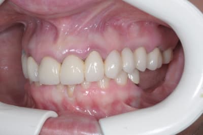 Edavant blaznl - Eugenol