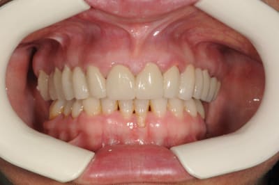 Efapres g8vlua - Eugenol