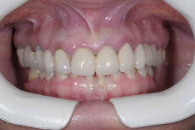 Efavant edteyc - Eugenol