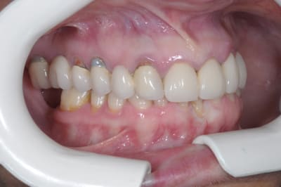 Egavant m6ghxo - Eugenol