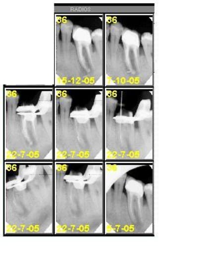 Et18d b8fnhq - Eugenol