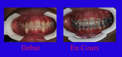 Eugenol anpmmc - Eugenol