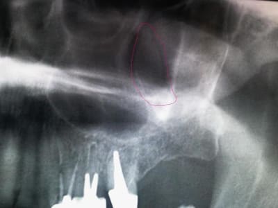 Eugenol gpowmm - Eugenol