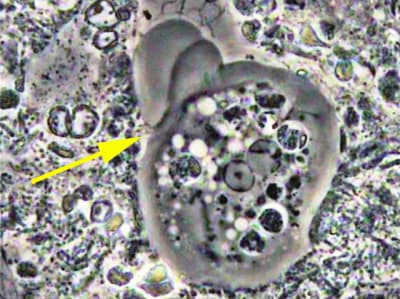 Entamoeba gingivalis se d placant dans le biofilm parodontal actif fl che 1000x myfdan - Eugenol
