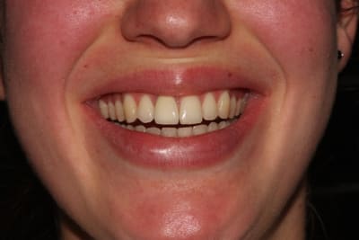 Essayage dootgu - Eugenol