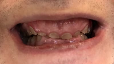 F210636b b920 48ee 9616 3728267b0311 w3y9lx - Eugenol