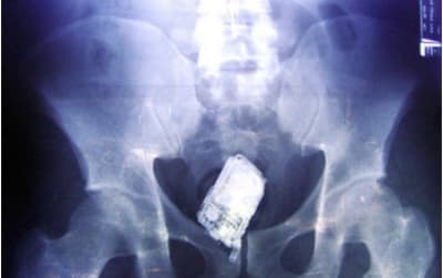 F4c5e34b e4bf 4f24 815b 723d031e7910 xbkelh - Eugenol