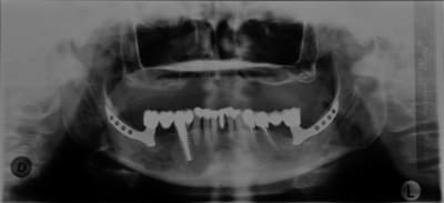 Fa  2  sdim0828 ayg9xb - Eugenol