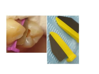 Fender wegde wuindk - Eugenol