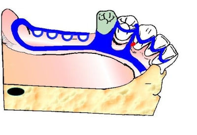Fini3 uagi8d - Eugenol