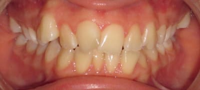 Face a g241e7 - Eugenol