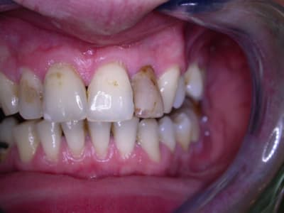 Farley01 n3jgpa - Eugenol