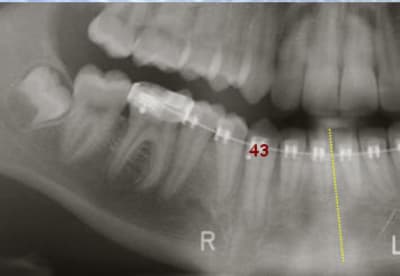 Fin 43 ein52k - Eugenol
