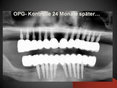 Folie8 j7lfcx - Eugenol