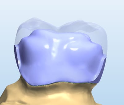 Gb399 u2mkgy - Eugenol