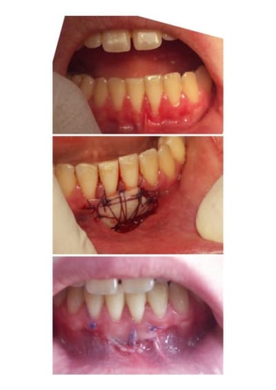 Gec rcswsb - Eugenol