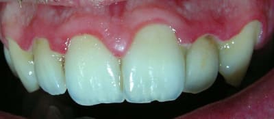 Gun initial ruty5i - Eugenol